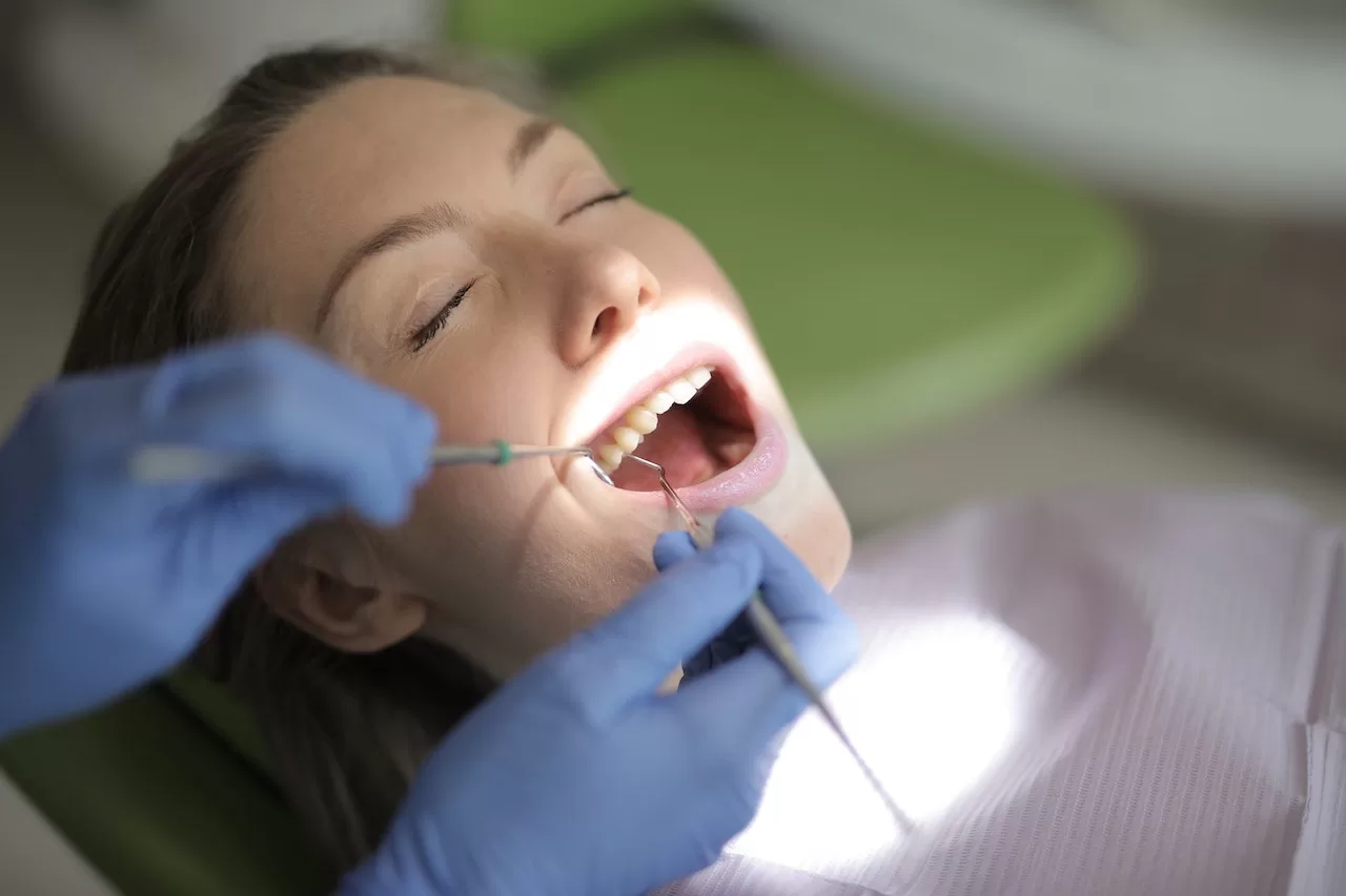 Facettes dentaires ratées : causes, conséquences et solutions
